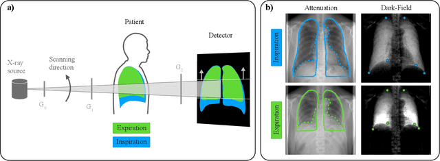 Figure 2 for Deformable Image Registration of Dark-Field Chest Radiographs for Local Lung Signal Change Assessment