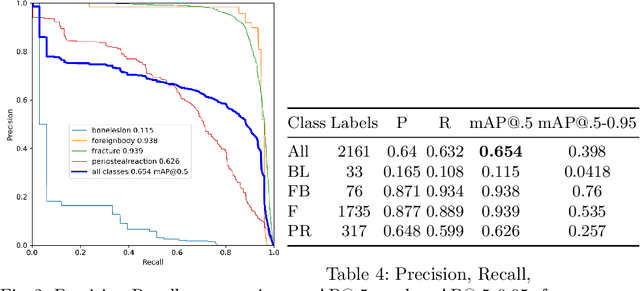 Figure 4 for DeepLOC: Deep Learning-based Bone Pathology Localization and Classification in Wrist X-ray Images