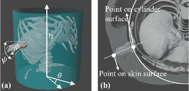 Figure 4 for Autonomous Path Planning for Intercostal Robotic Ultrasound Imaging Using Reinforcement Learning