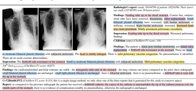 Figure 4 for Longitudinal Data and a Semantic Similarity Reward for Chest X-Ray Report Generation