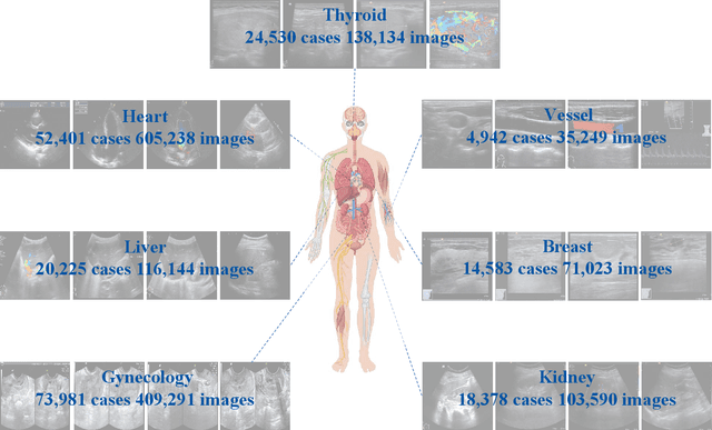Figure 3 for EchoVLM: Dynamic Mixture-of-Experts Vision-Language Model for Universal Ultrasound Intelligence