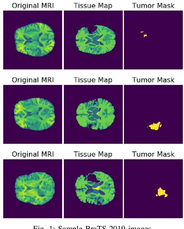 Figure 1 for CU-Net: a U-Net architecture for efficient brain-tumor segmentation on BraTS 2019 dataset