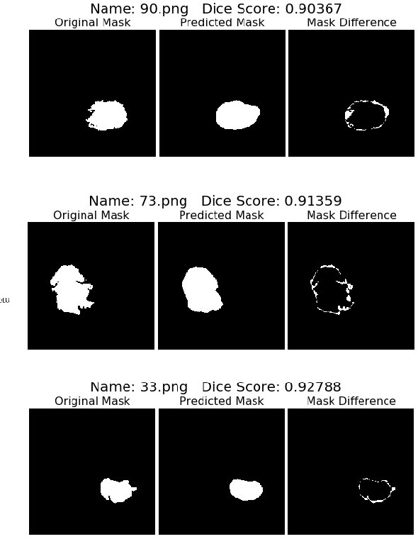 Figure 3 for CU-Net: a U-Net architecture for efficient brain-tumor segmentation on BraTS 2019 dataset
