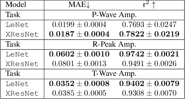 Figure 2 for Explaining Deep Learning for ECG Analysis: Building Blocks for Auditing and Knowledge Discovery