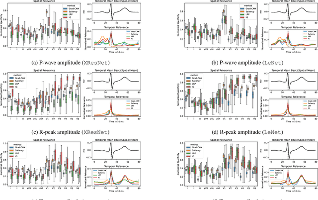 Figure 3 for Explaining Deep Learning for ECG Analysis: Building Blocks for Auditing and Knowledge Discovery