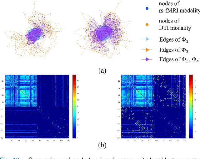 Figure 2 for A Heterogeneous Graph Neural Network Fusing Functional and Structural Connectivity for MCI Diagnosis