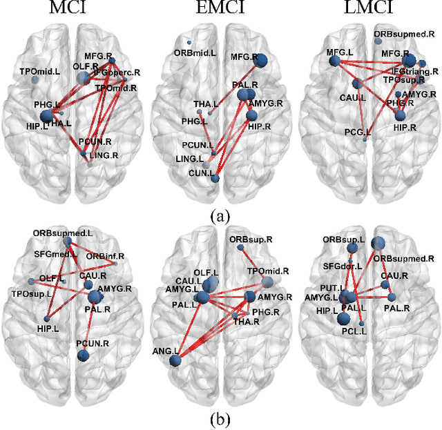 Figure 4 for A Heterogeneous Graph Neural Network Fusing Functional and Structural Connectivity for MCI Diagnosis