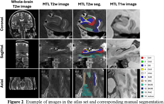 Figure 3 for Development of an isotropic segmentation model for medial temporal lobe subregions on anisotropic MRI atlas using implicit neural representation