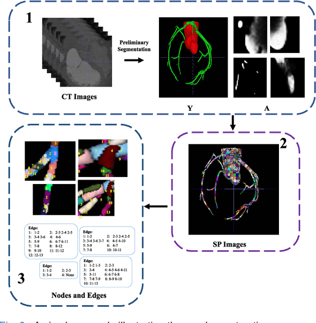 Figure 2 for Graph Convolution Based Cross-Network Multi-Scale Feature Fusion for Deep Vessel Segmentation