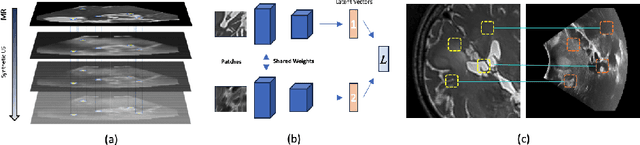 Figure 1 for Learning to Match 2D Keypoints Across Preoperative MR and Intraoperative Ultrasound