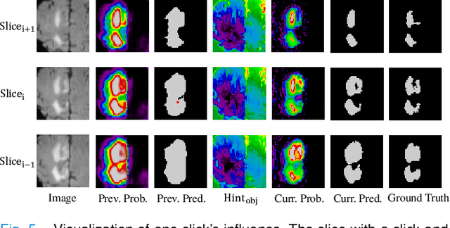 Figure 4 for Boundary-aware Supervoxel-level Iteratively Refined Interactive 3D Image Segmentation with Multi-agent Reinforcement Learning