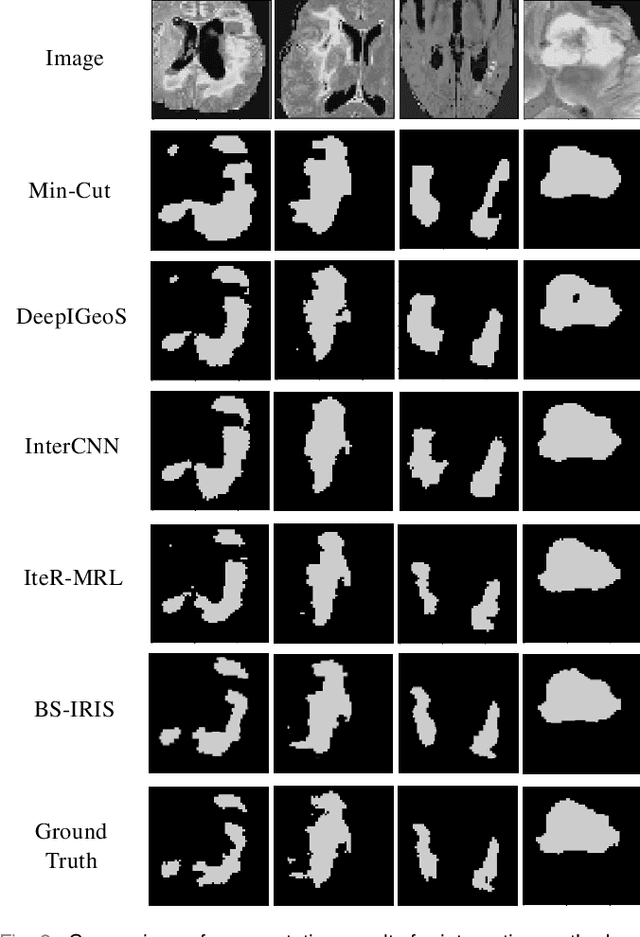 Figure 2 for Boundary-aware Supervoxel-level Iteratively Refined Interactive 3D Image Segmentation with Multi-agent Reinforcement Learning