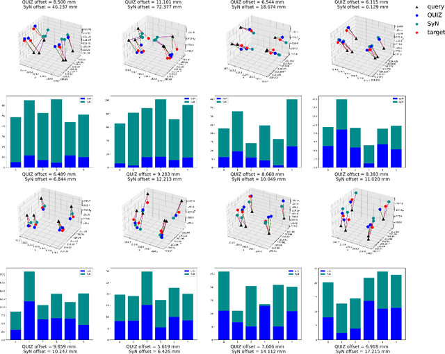 Figure 3 for QUIZ: An Arbitrary Volumetric Point Matching Method for Medical Image Registration