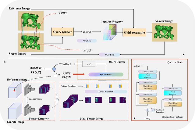 Figure 1 for QUIZ: An Arbitrary Volumetric Point Matching Method for Medical Image Registration