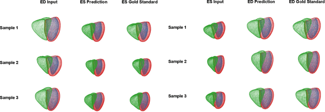 Figure 3 for Modeling 3D cardiac contraction and relaxation with point cloud deformation networks
