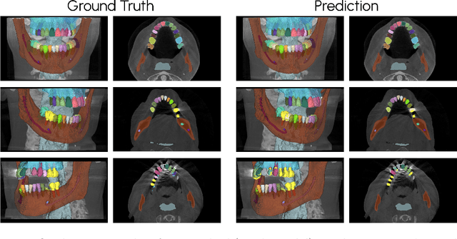 Figure 2 for Scaling nnU-Net for CBCT Segmentation