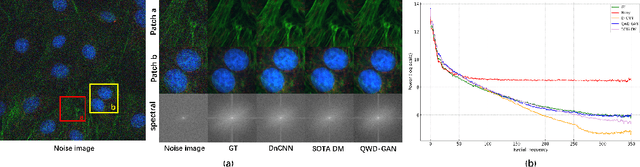 Figure 1 for QWD-GAN: Quality-aware Wavelet-driven GAN for Unsupervised Medical Microscopy Images Denoising