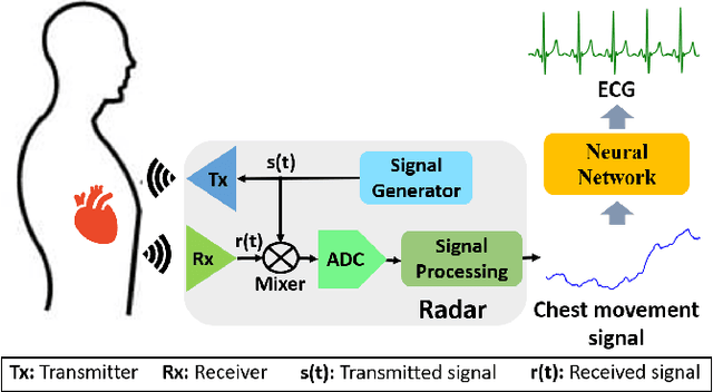 Figure 1 for LifWavNet: Lifting Wavelet-based Network for Non-contact ECG Reconstruction from Radar