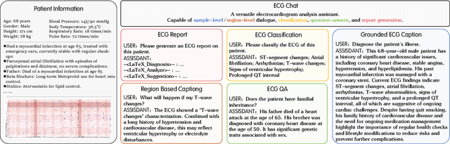Figure 1 for ECG-Chat: A Large ECG-Language Model for Cardiac Disease Diagnosis