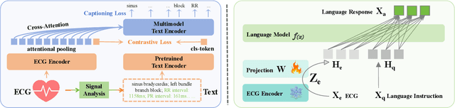 Figure 3 for ECG-Chat: A Large ECG-Language Model for Cardiac Disease Diagnosis