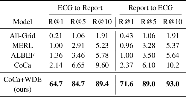 Figure 2 for ECG-Chat: A Large ECG-Language Model for Cardiac Disease Diagnosis