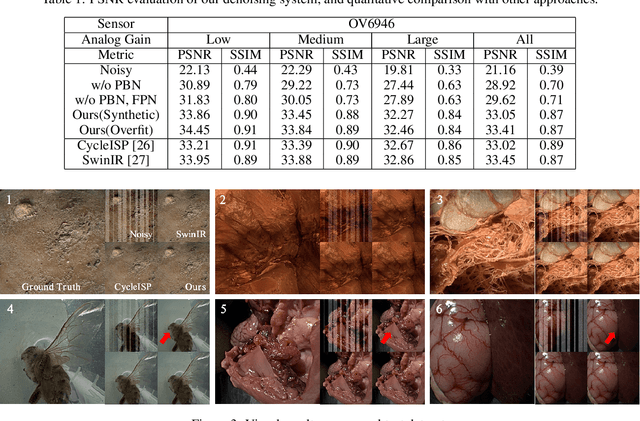 Figure 2 for A Real-time Endoscopic Image Denoising System