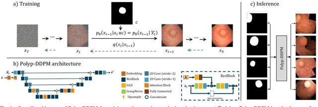 Figure 1 for Polyp-DDPM: Diffusion-Based Semantic Polyp Synthesis for Enhanced Segmentation