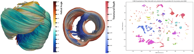 Figure 3 for Deep Representation Learning for Unsupervised Clustering of Myocardial Fiber Trajectories in Cardiac Diffusion Tensor Imaging