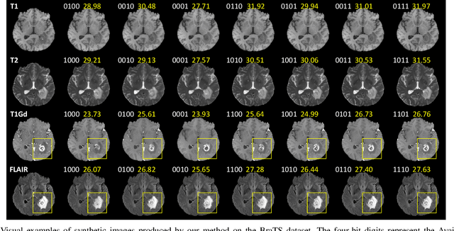 Figure 4 for Unified Multi-Modal Image Synthesis for Missing Modality Imputation