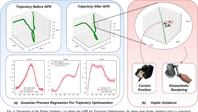 Figure 4 for TIMS: A Tactile Internet-Based Micromanipulation System with Haptic Guidance for Surgical Training