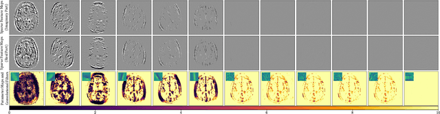 Figure 2 for Learning Spatially Adaptive $\ell_1$-Norms Weights for Convolutional Synthesis Regularization