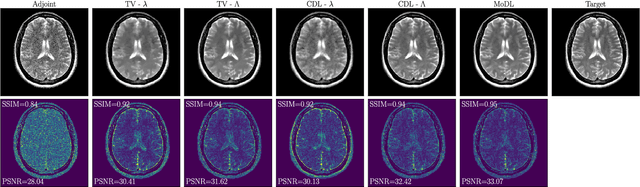 Figure 3 for Learning Spatially Adaptive $\ell_1$-Norms Weights for Convolutional Synthesis Regularization