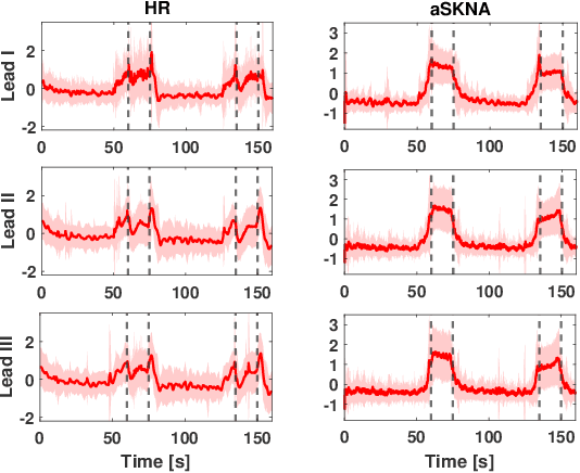Figure 2 for A Mathematical Model for Skin Sympathetic Nerve Activity Simulation