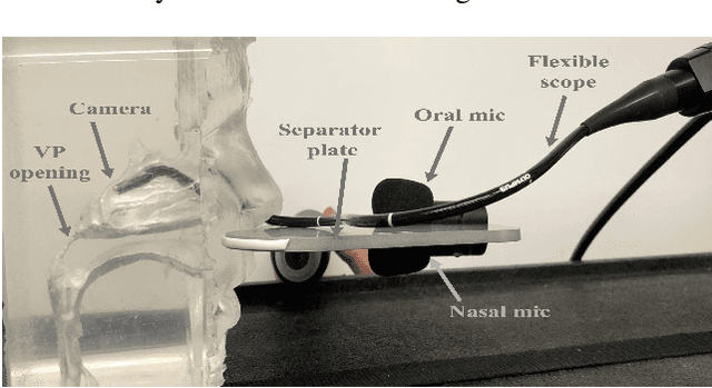 Figure 1 for Acoustic to Articulatory Speech Inversion for Children with Velopharyngeal Insufficiency