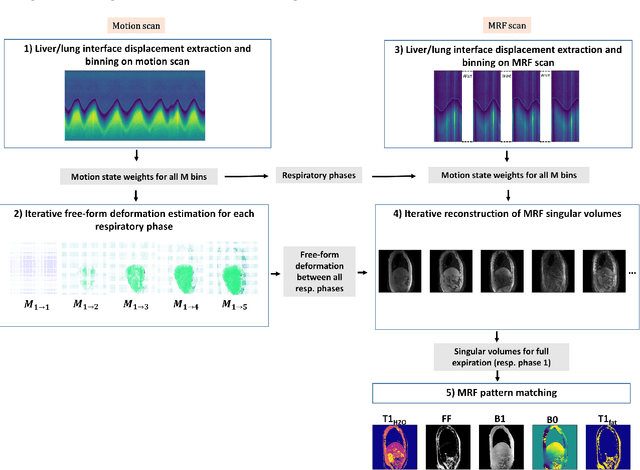 Figure 1 for Upper-body free-breathing Magnetic Resonance Fingerprinting applied to the quantification of water T1 and fat fraction