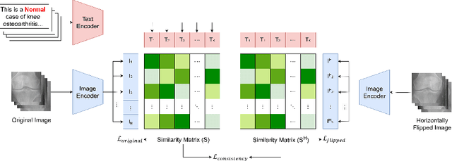 Figure 1 for CLIP-KOA: Enhancing Knee Osteoarthritis Diagnosis with Multi-Modal Learning and Symmetry-Aware Loss Functions