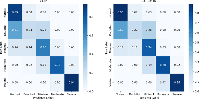Figure 4 for CLIP-KOA: Enhancing Knee Osteoarthritis Diagnosis with Multi-Modal Learning and Symmetry-Aware Loss Functions