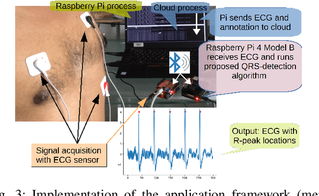 Figure 3 for Optimising complexity of CNN models for resource constrained devices: QRS detection case study