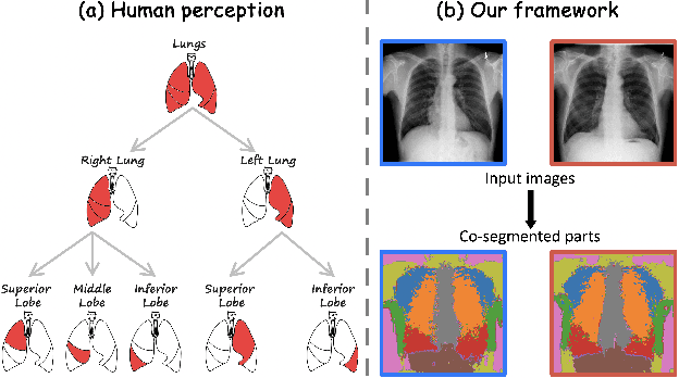 Figure 1 for Representing Part-Whole Hierarchies in Foundation Models by Learning Localizability, Composability, and Decomposability from Anatomy via Self-Supervision