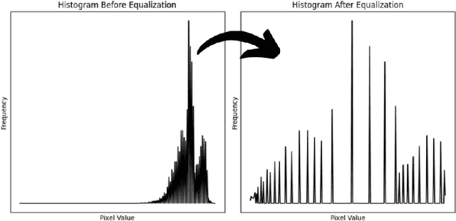 Figure 3 for Medical X-Ray Image Enhancement Using Global Contrast-Limited Adaptive Histogram Equalization