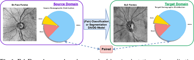 Figure 1 for FairDomain: Achieving Fairness in Cross-Domain Medical Image Segmentation and Classification