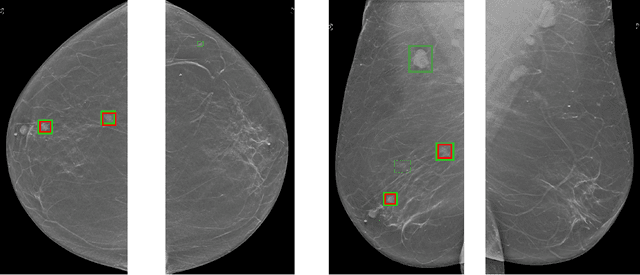 Figure 4 for A Multi-Modal AI System for Screening Mammography: Integrating 2D and 3D Imaging to Improve Breast Cancer Detection in a Prospective Clinical Study