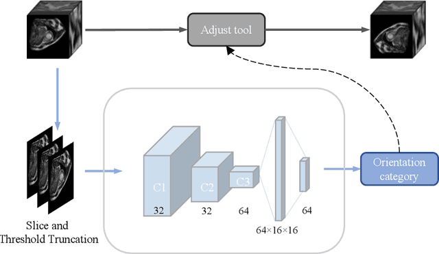 Figure 3 for Orientation recognition and correction of Cardiac MRI with deep neural network