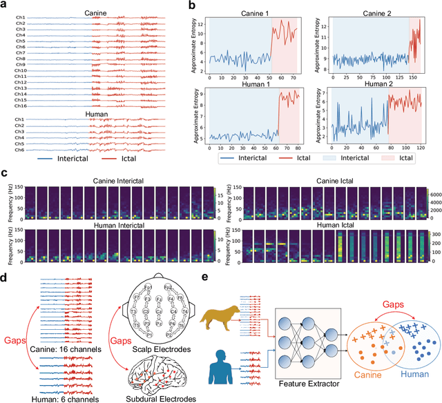 Figure 1 for Cross-Species and Cross-Modality Epileptic Seizure Detection via Multi-Space Alignment