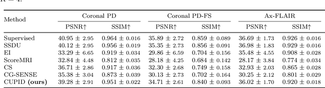 Figure 4 for Training Physics-Driven Deep Learning Reconstruction without Raw Data Access for Equitable Fast MRI