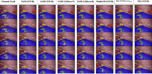 Figure 4 for Feature-EndoGaussian: Feature Distilled Gaussian Splatting in Surgical Deformable Scene Reconstruction