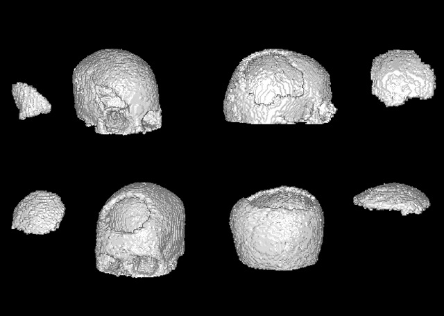 Figure 1 for Deep Generative Networks for Heterogeneous Augmentation of Cranial Defects