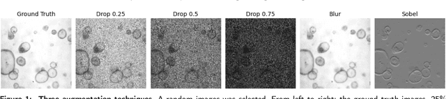 Figure 1 for Self-Supervised Versus Supervised Training for Segmentation of Organoid Images