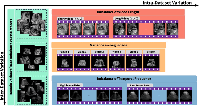 Figure 1 for Towards Better Ultrasound Video Segmentation Foundation Model: An Empirical study on SAM2 Finetuning from Data Perspective