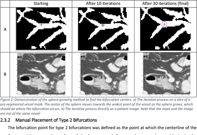 Figure 3 for A Vessel Bifurcation Landmark Pair Dataset for Abdominal CT Deformable Image Registration (DIR) Validation